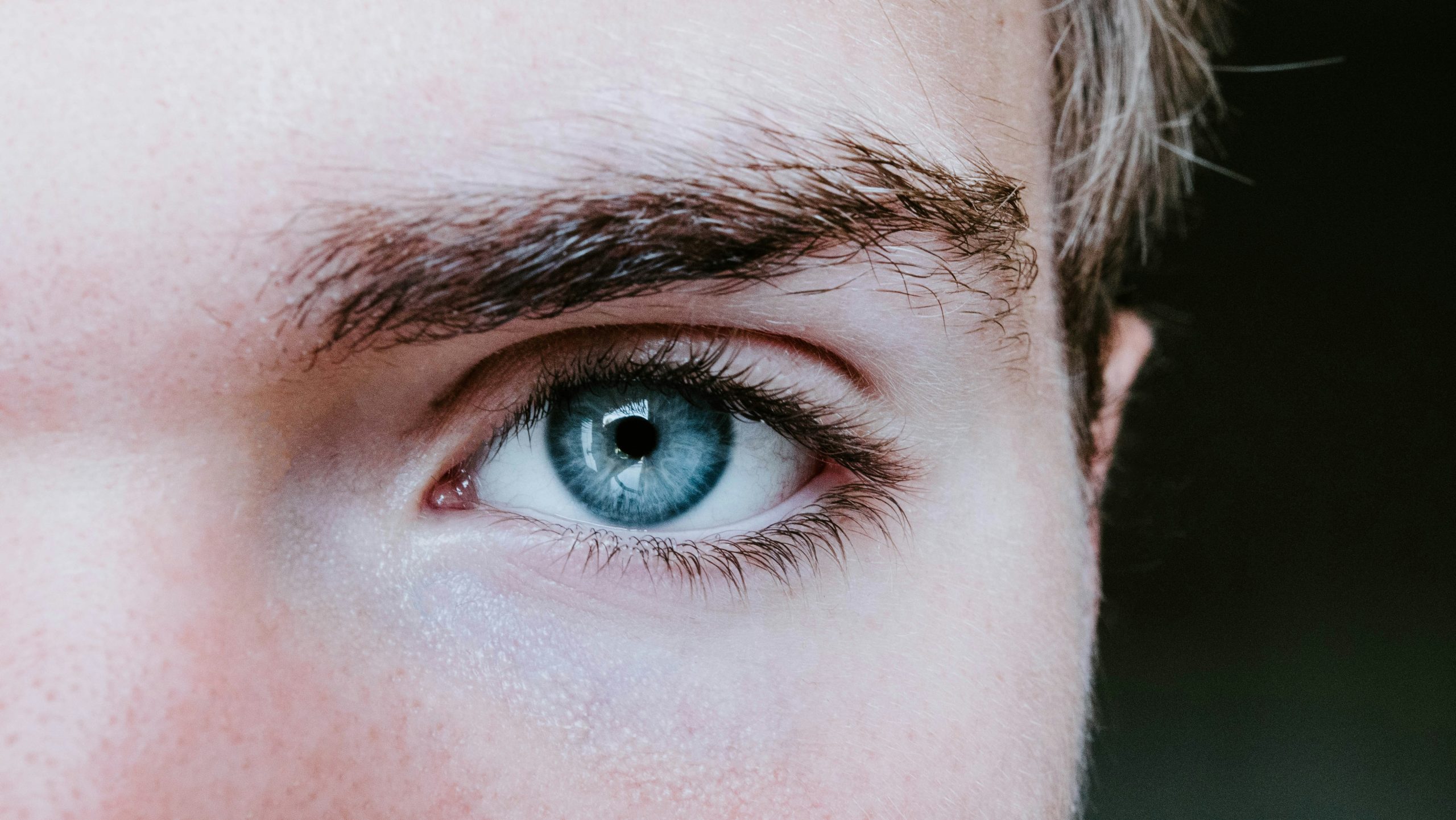 Eyebrow transplant